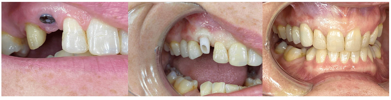 Screen Shot 2022-09-19 at 3.55.38 pm